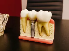 Descubre el mejor seguro dental para cubrir los costos de tu ortodoncia