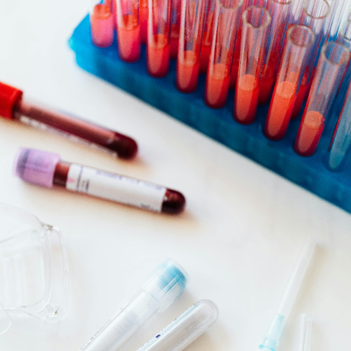 Análisis del test de embarazo de Lidl: ¿El mejor producto del supermercado online? Descúbrelo aquí