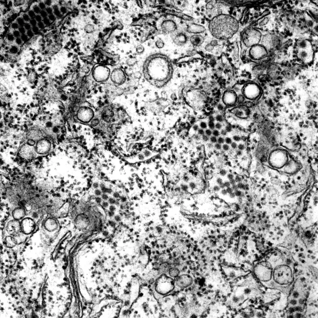 membrana ultrafiltracion